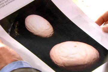 Galinha bota ovos enrugados e com casca áspera. Programa exibido em 2013.