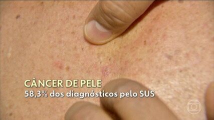 O problema do diagnóstico tardio do câncer de pele